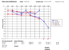 Chart: Audiogram Chart